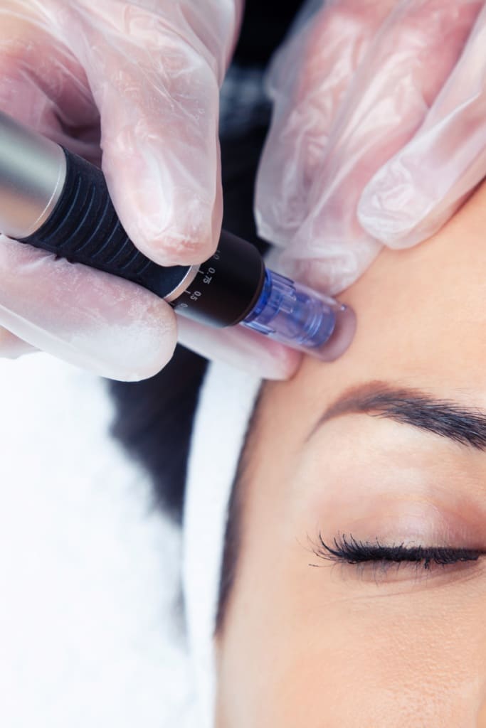 Microneedling – Collagen P.I.N.